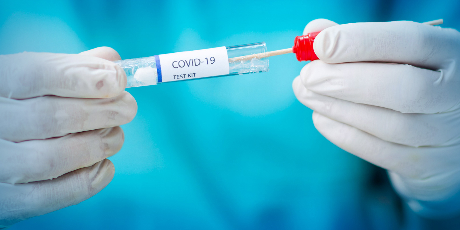 Hiểu thêm về các phương pháp xét nghiệm COVID-19