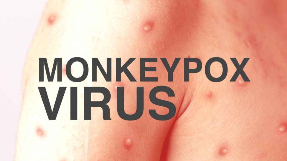 What is Monkeypox?